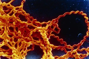 Возбудители лептоспироза