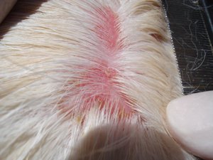 Кожные заболевания