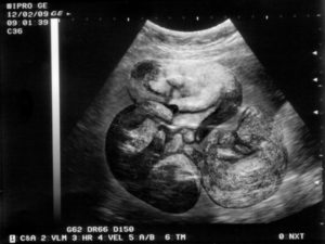 Беременность у кошек