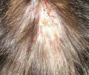 Блошиный дерматит 