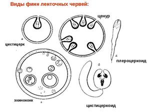 Ленточный червь