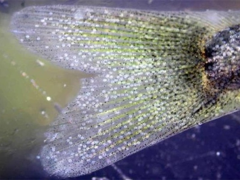 Что за болезнь триходиноз Триходиноз