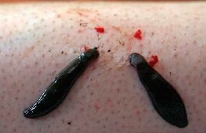 Кольчатые черви: откуда взялся этот тип