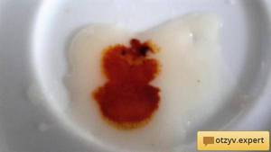 Реакция йода на мед