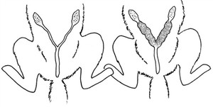 Матка при пиометре