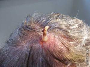 Овод и его личинки: опасный паразит для человека и животных